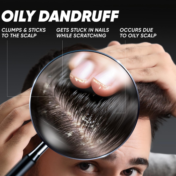 Head & Shoulders Deep Cleanse Anti-Dandruff Shampoo, Active Charcoal  – image 3
