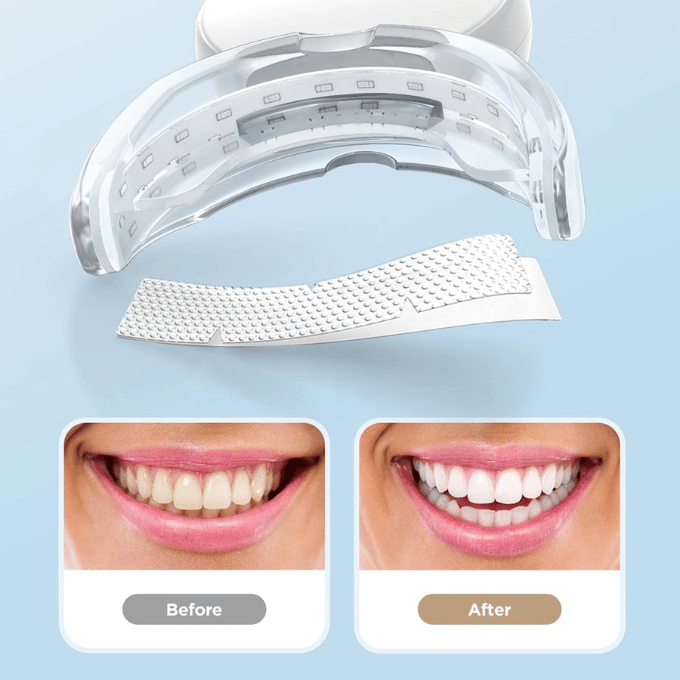 AGARO Dazzle Instant Teeth Whitening Kit with 14 Pcs Strips, Manual Dental Whitening Kit for adults,