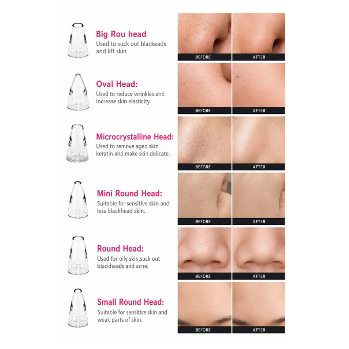 Face Cleaner | Multi- Functional Cleaning | Remove Blackhead & Whitehead Device. – image 4